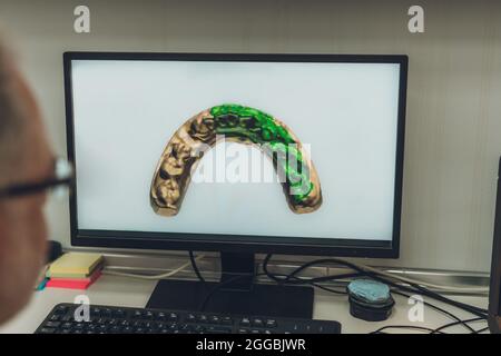 Professional looking at a computer screen with a scanned image of a dental mould in a laboratory Stock Photo