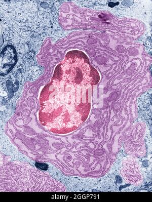 Tem Insect Nuscle Transmission electron micrograph (TEM) showing the nucleus (with a ...