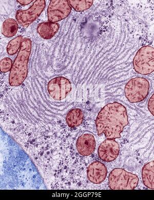 Colorized transmission Electron Micrograph (TEM) of endoplasmic reticulum and mitochondria in the liver of a rat.