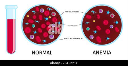 red blood cell diagram labeled