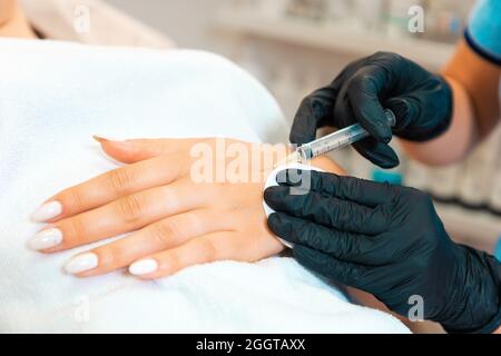 Cosmetologist makes injections of botulinum toxin on the client's hand against hyperhidrosis. Close up. Procedure in beauty salon. Stock Photo