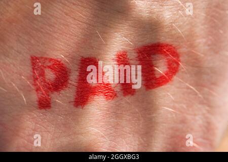 Red ink stamp with the word paid on the back of a hand Stock Photo