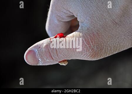 Close up wound after bouldering in Switzerland. Climbing accident. Stock Photo