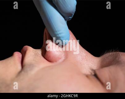 The doctor's hand holds the patient's large nose to reduce it. Concept of correction of a man's nose using modern plastic surgery, rhinoplasty Stock Photo