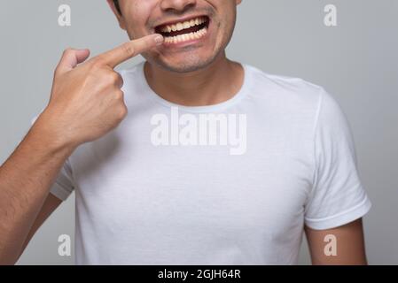 Hispanic-looking Mexican man with yellow teeth, Chinese-haired young man in white shirt with gray background back, points his finger to his mouth Stock Photo