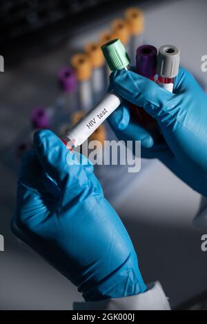 Blood tests to detect sexually transmitted diseases or STDs: hepatitis B and C, syphilis, HIV. Stock Photo