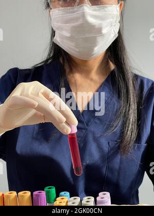 The serological test is done with a blood test to look for the presence ...