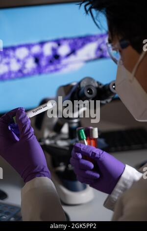 Blood test for syphilis caused by the bacterium treponema pallidum or pale treponema. This infection is sexually transmitted. Stock Photo