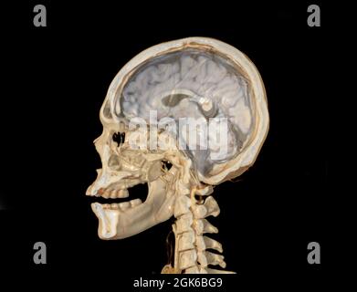 A Haft of the skull 3D showing the brain . Stock Photo