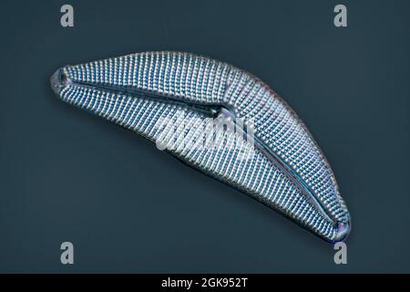 diatom (Diatomeae), Diatoms from Emeralda, light microscopy, differential interference contrast, magnification x 140 related to a print of 35 mm Stock Photo