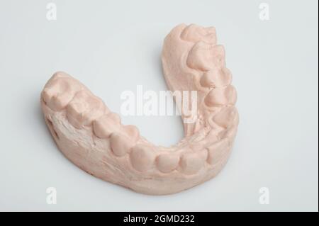 Model of human jaw isometric view isolated on white studio background Stock Photo