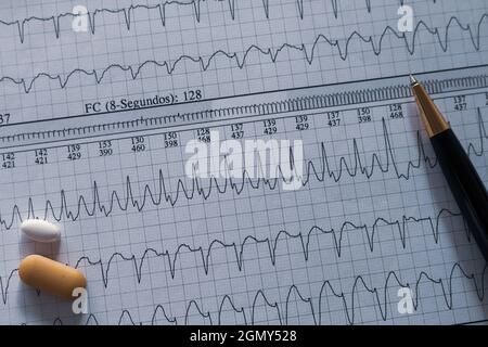 Desk of a doctor. Elements that a cardiologist uses in his work. Patient study material. Stock Photo