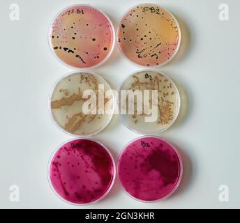 Bacterial colony on selective media Agar Plates in petri dish Stock Photo