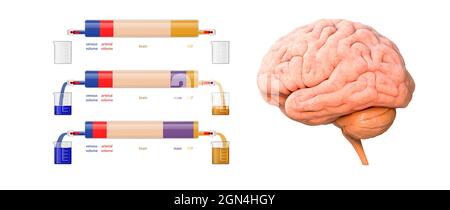 Brain, mass, arterial volume, venous volume, CSF - cerebrospinal fluid acronym, medical concept background, 3d render illustration Stock Photo