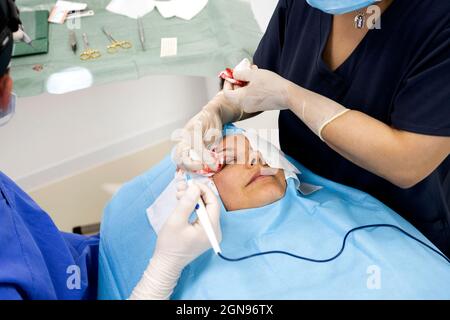 Plastic surgery operation, modifying the eye region in medical clinic Stock Photo