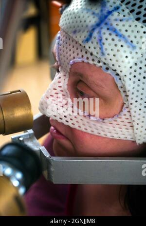 Proton beam therapy for treatment of a carcinoma within the eye. Stock Photo