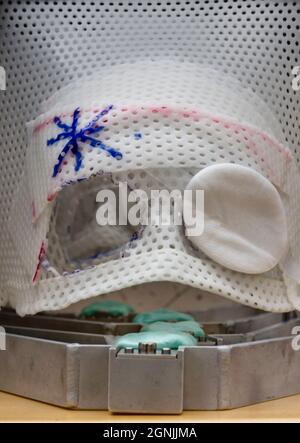 Semi-rigid mask for a patient undergoing proton beam therapy for tumours in the eye. Stock Photo