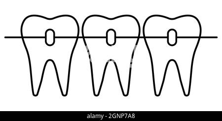 Dental braces icon, orthodontic teeth alignment for a beautiful smile Stock Vector