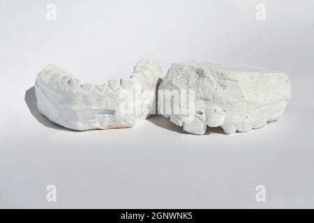 Dental gypsum model cast stomatologic human jaws Stock Photo