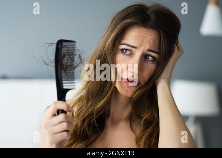 Woman Suffering From Hairloss Or Hairfall Problem Stock Photo