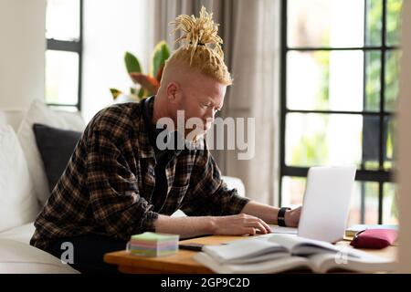 Albino african american man with dreadlocks working from home and using laptop Stock Photo
