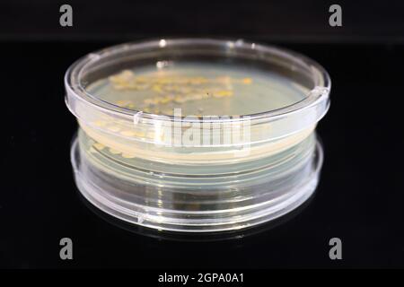 A petri dish with common yeast and bacteria colonies. Stock Photo