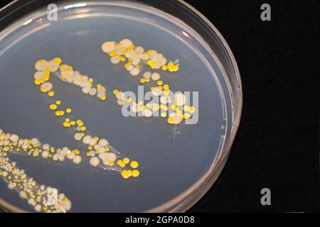 An agar dish with bacteria and fungi colonies against black. Stock Photo