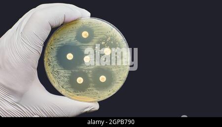 Antimicrobial susceptibility test by diffusion kirby bauer on dark ...