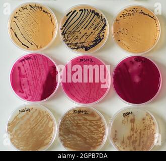 bacteria colonies on Selective media Agar Plates in various petri dish  Stock Photo