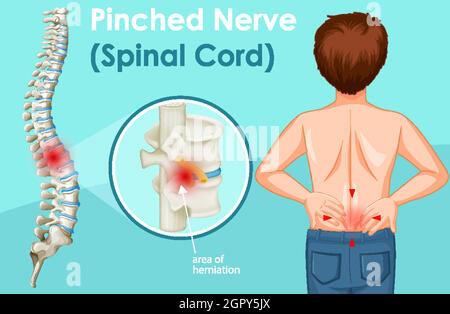 Diagram showing back pain in human Stock Vector