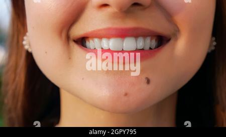unrecognizable young woman with straight white teeth smiling at camera Stock Photo