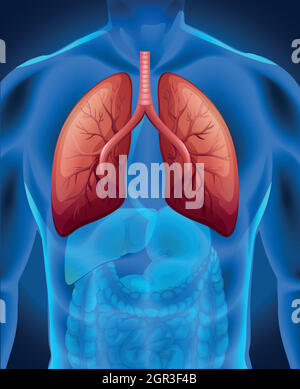 Lung cancer diagram in human Stock Vector Image & Art - Alamy