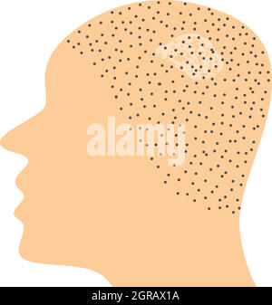Fungal infection on scalp Stock Vector