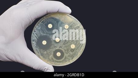 Antimicrobial susceptibility test by diffusion kirby bauer on dark ...