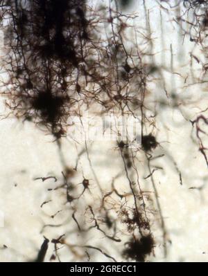 Mouse brain section stained with the Golgi stain, a 19th century technique that was  widely used until recently -  and occasionally still is. Stock Photo