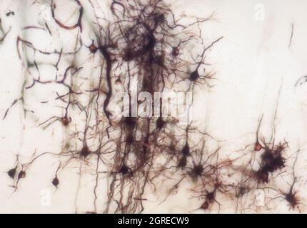 Mouse brain section stained with the Golgi stain, a 19th century technique that was  widely used until recently -  and occasionally still is. Stock Photo