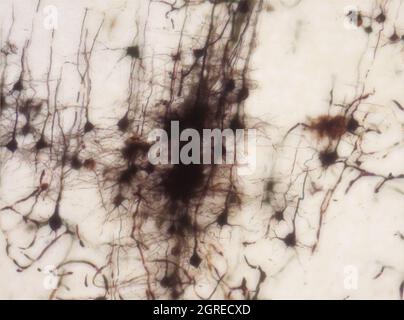 Mouse brain section stained with the Golgi stain, a 19th century technique that was  widely used until recently -  and occasionally still is. Stock Photo