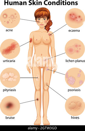 A Human Anatomy of Human Skin Condition Stock Vector