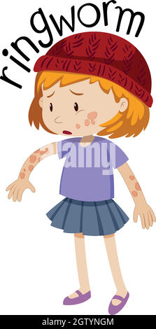 Little girl with ringworm on body Stock Vector
