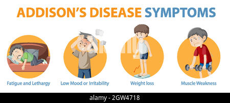 Medical infographic of Addison's disease symptoms illustration Stock ...