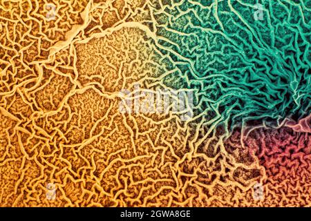 The tissue of a biological organism is affected by two types of cancer cells. Electron microscopy. Concept image of mutational processes under the inf Stock Photo