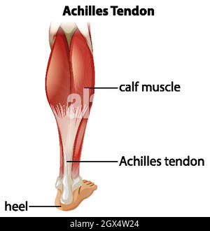 Medical infographic of achilles tendon Stock Vector