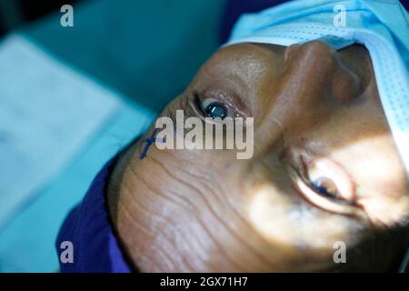 Kathmandu, Nepal. 4th Oct, 2021. A patient waits for a cataract eye surgery inside the operation theater at Tilganga Eye Hospital in Kathmandu, Nepal on Monday, October 4, 2021. (Credit Image: © Skanda Gautam/ZUMA Press Wire) Stock Photo
