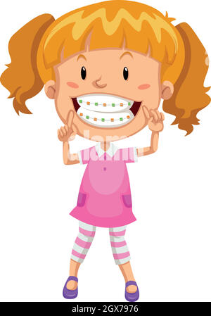 Little girl with braces Stock Vector