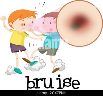 Boys Fighting and Having Bruise Stock Vector