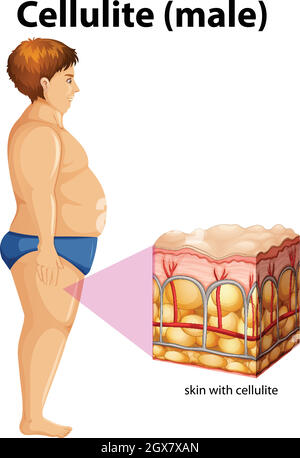 A fat man with cellulite Stock Vector