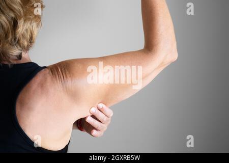 Older Woman Cosmetic Liposuction Surgery And Body Fat Check Stock Photo