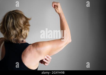 Older Woman Cosmetic Liposuction Surgery And Body Fat Check Stock Photo