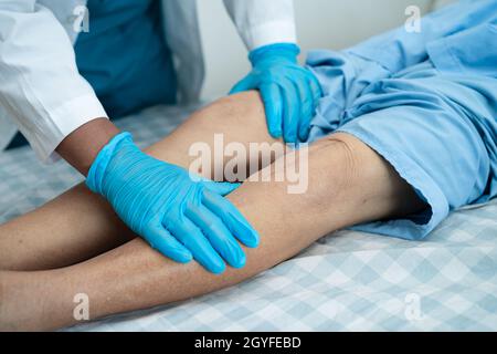 Asian senior or elderly old lady woman patient show her scars surgical total knee joint replacement Suture wound surgery arthroplasty on bed in nursin Stock Photo