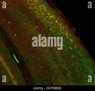 Confocal laser scanning microscopy image of immunofluorescence-labelled cells in the cerebral cortex of the mouse brain Stock Photo